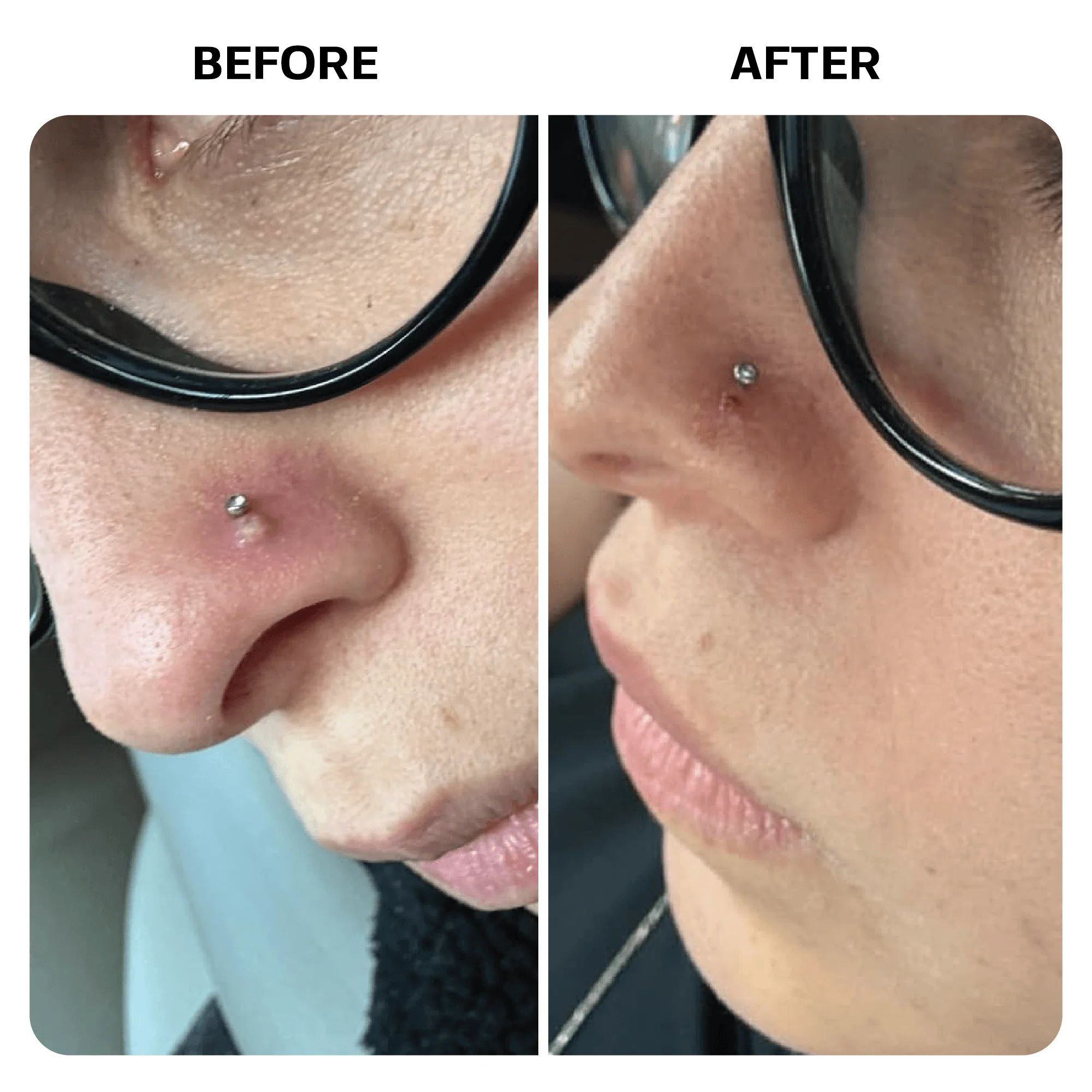 Piercing Aftercare Spray - Image 10