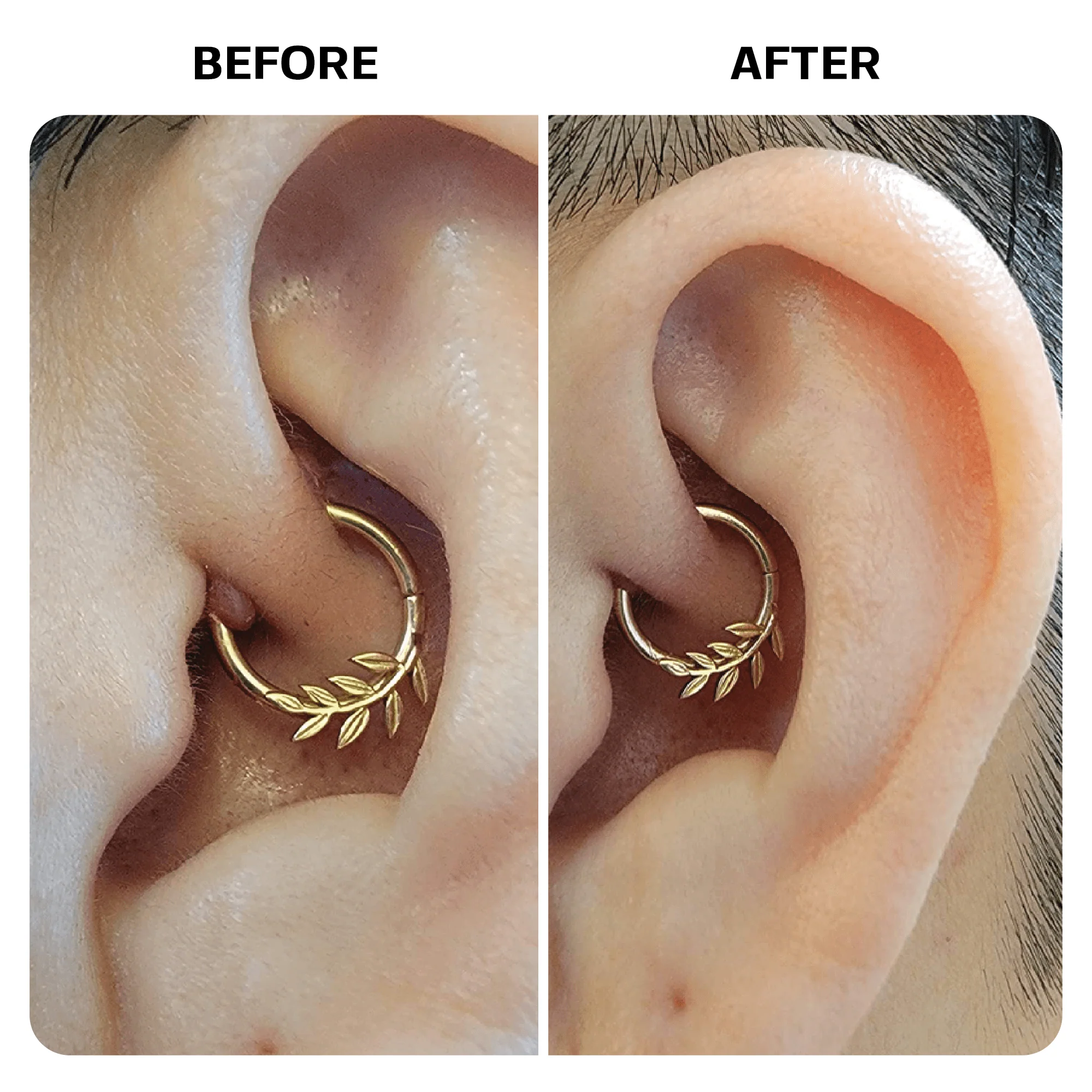 Piercing Aftercare Spray - Image 8