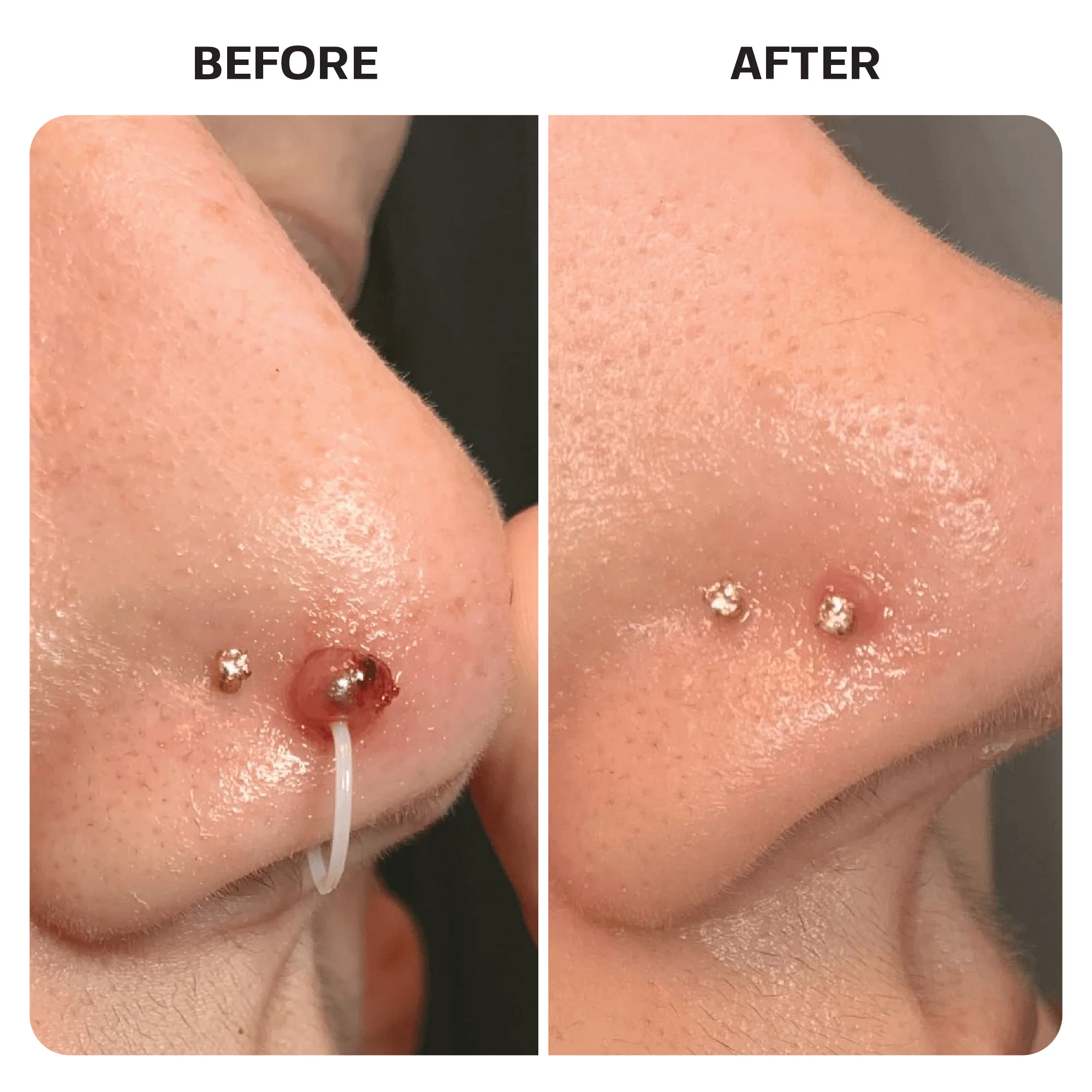 Piercing Aftercare Spray - Image 9