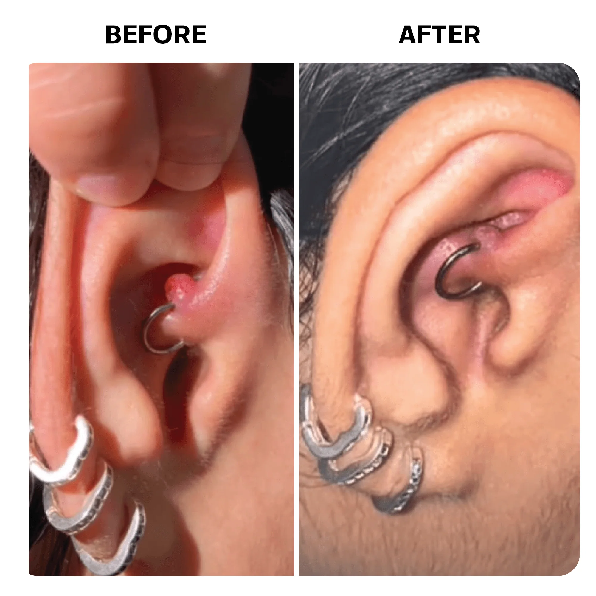 Piercing Bump Oil - Image 10