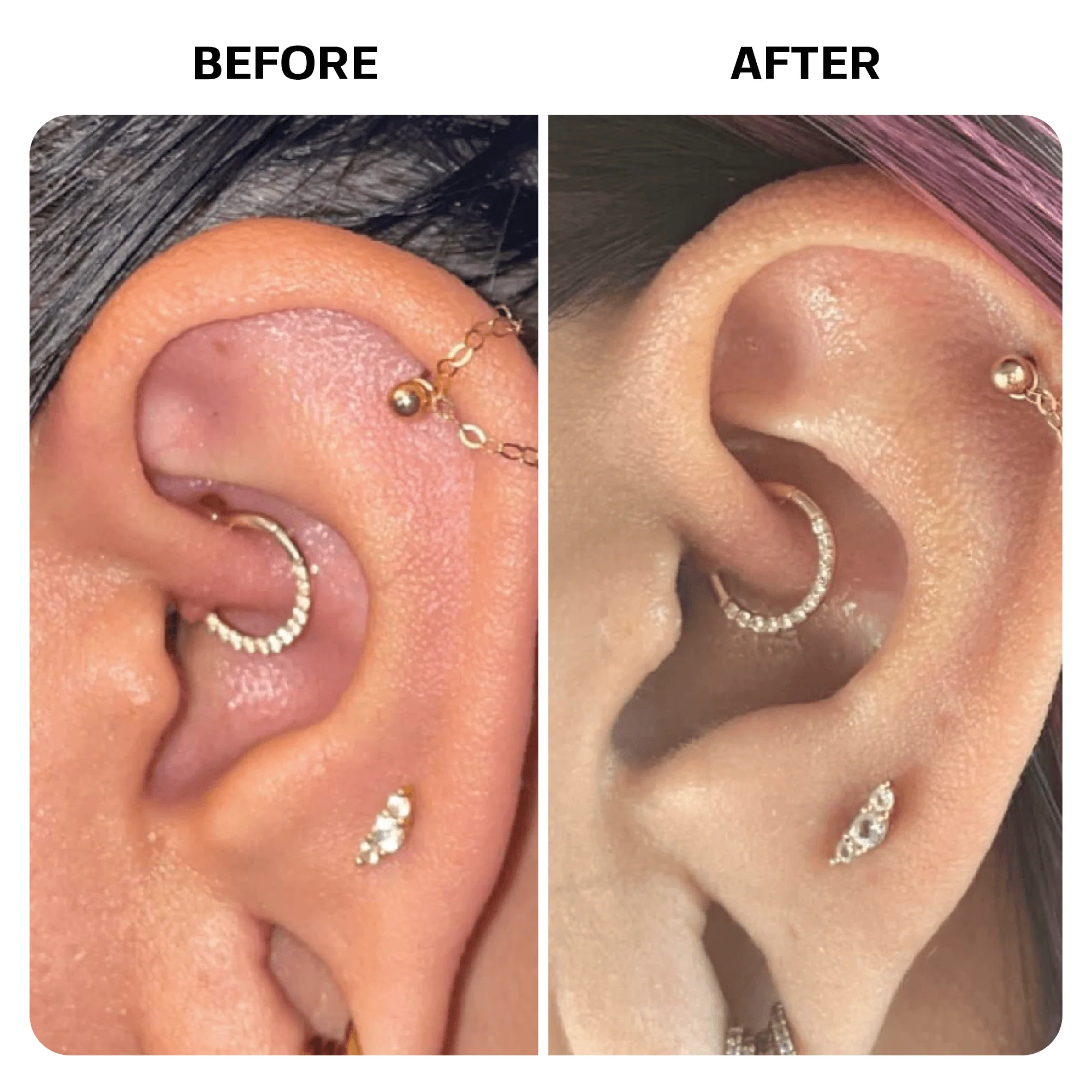Piercing Bump Oil - Image 8