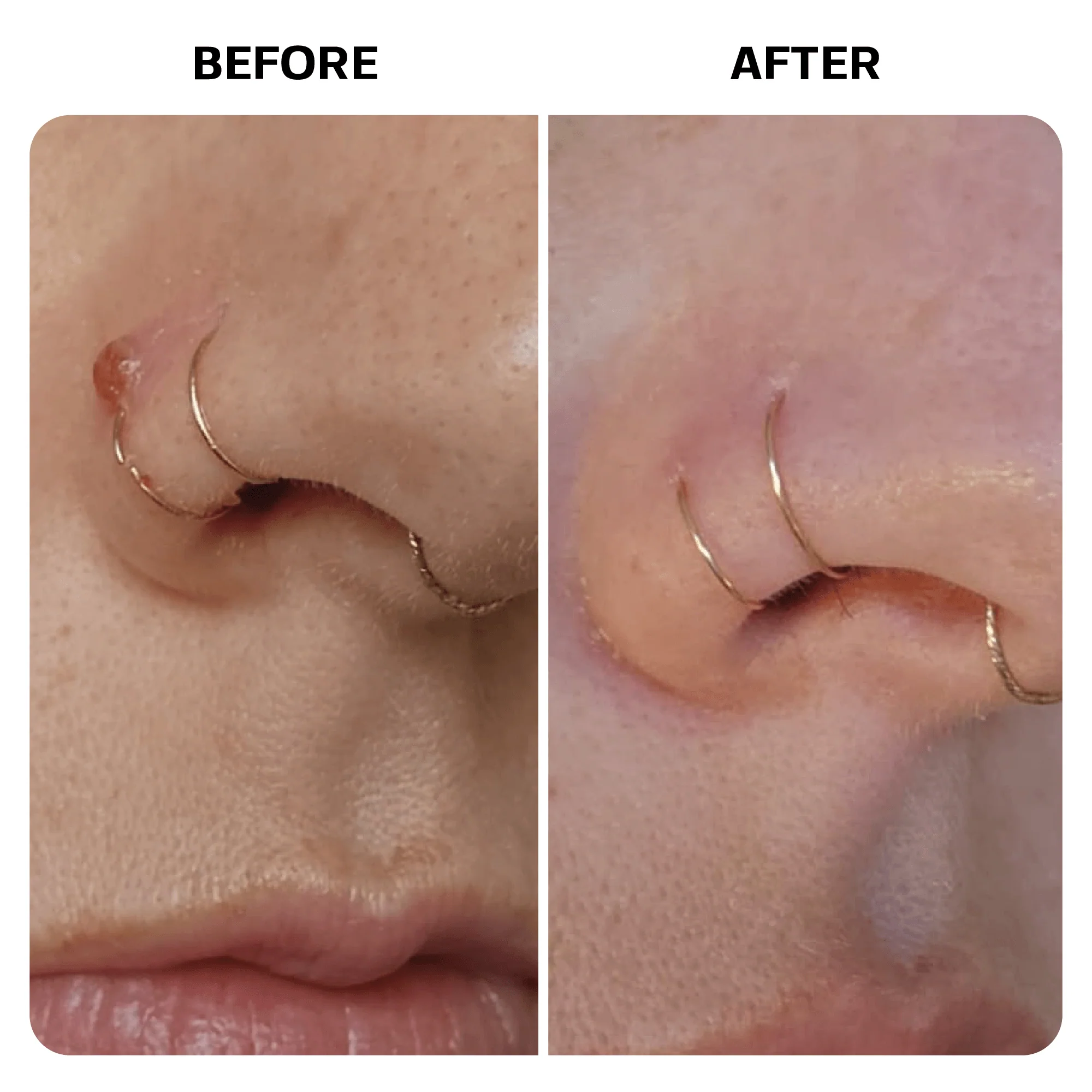 Piercing Bump Oil - Image 9