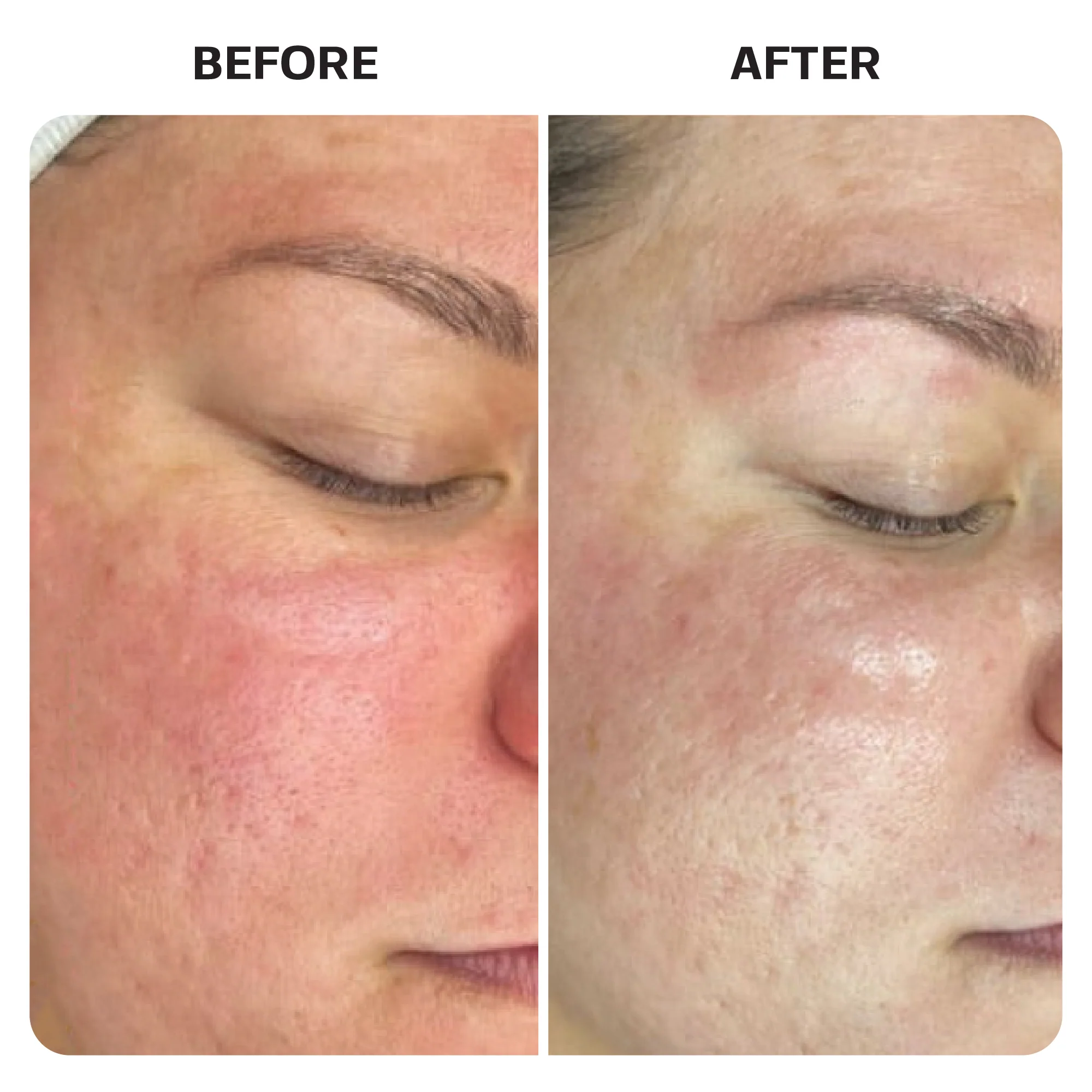Hypochlorous Acid Spray - Image 8