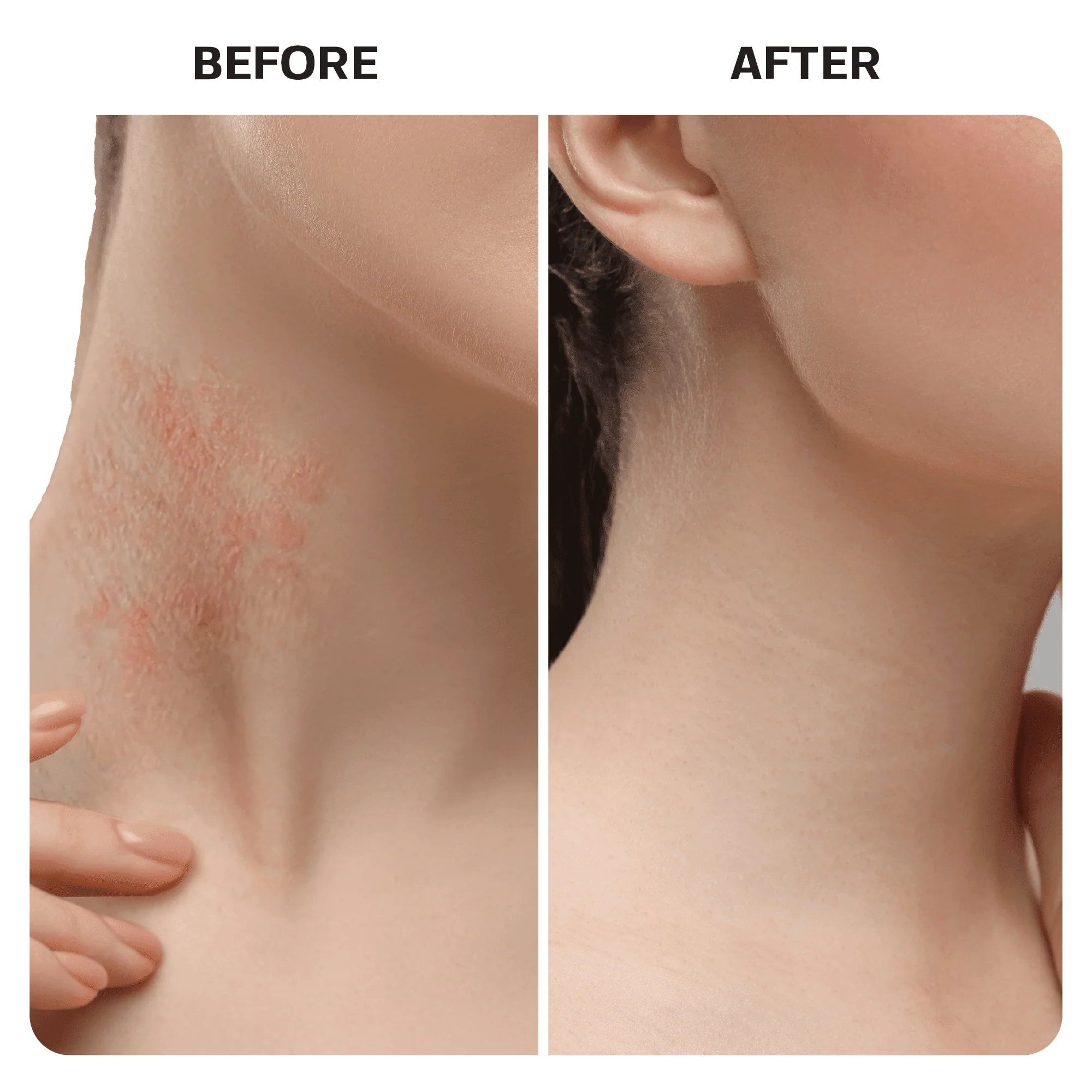 Hypochlorous Acid Spray - Image 9