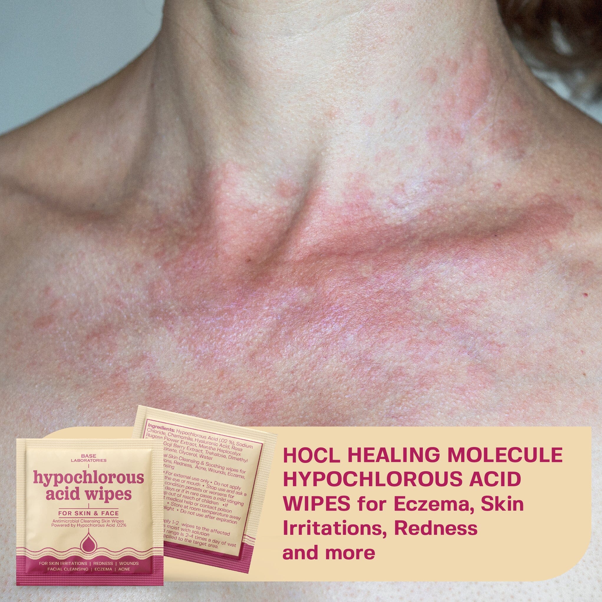 Hypochlorous Acid Wipes - Image 3