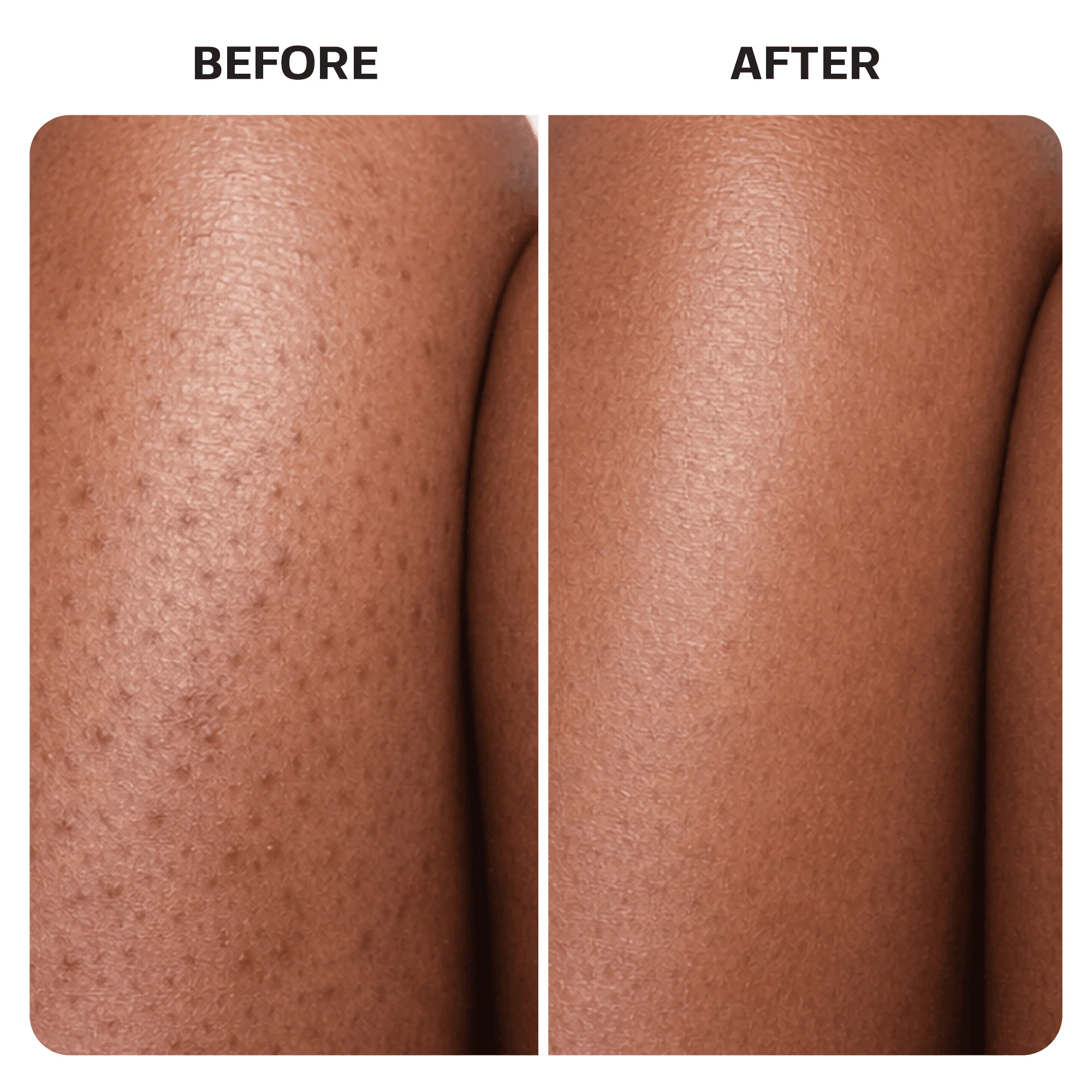 Ingrown Hair Treatment Oil - Image 10