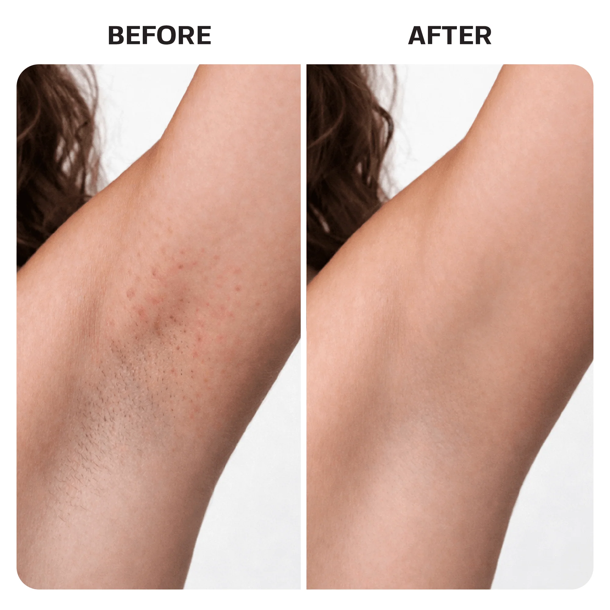 Ingrown Hair Treatment Oil - Image 9
