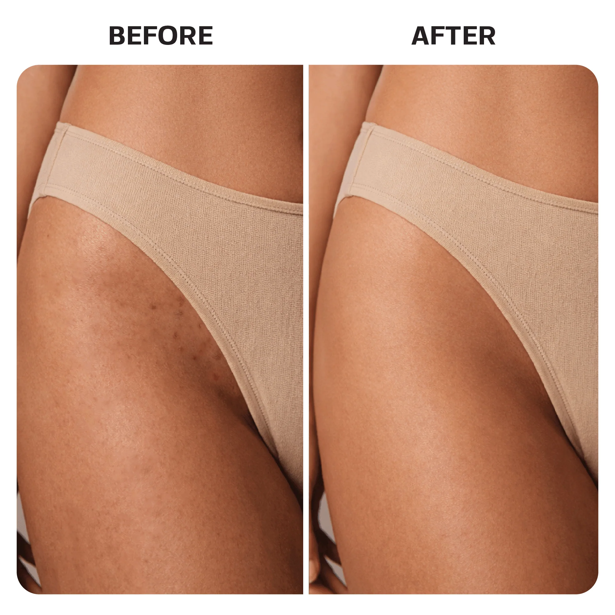 Ingrown Hair Treatment Pads - Image 7