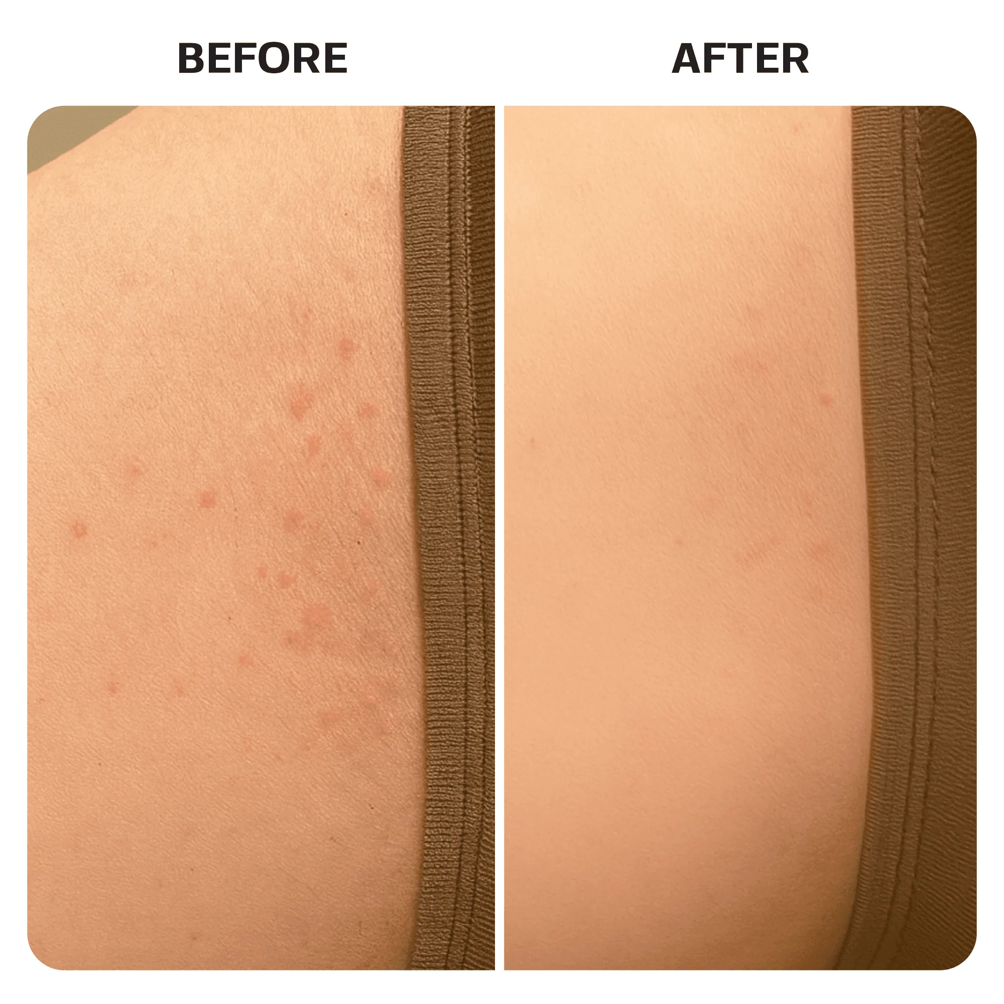 Ingrown Hair Roller Serum - Image 10