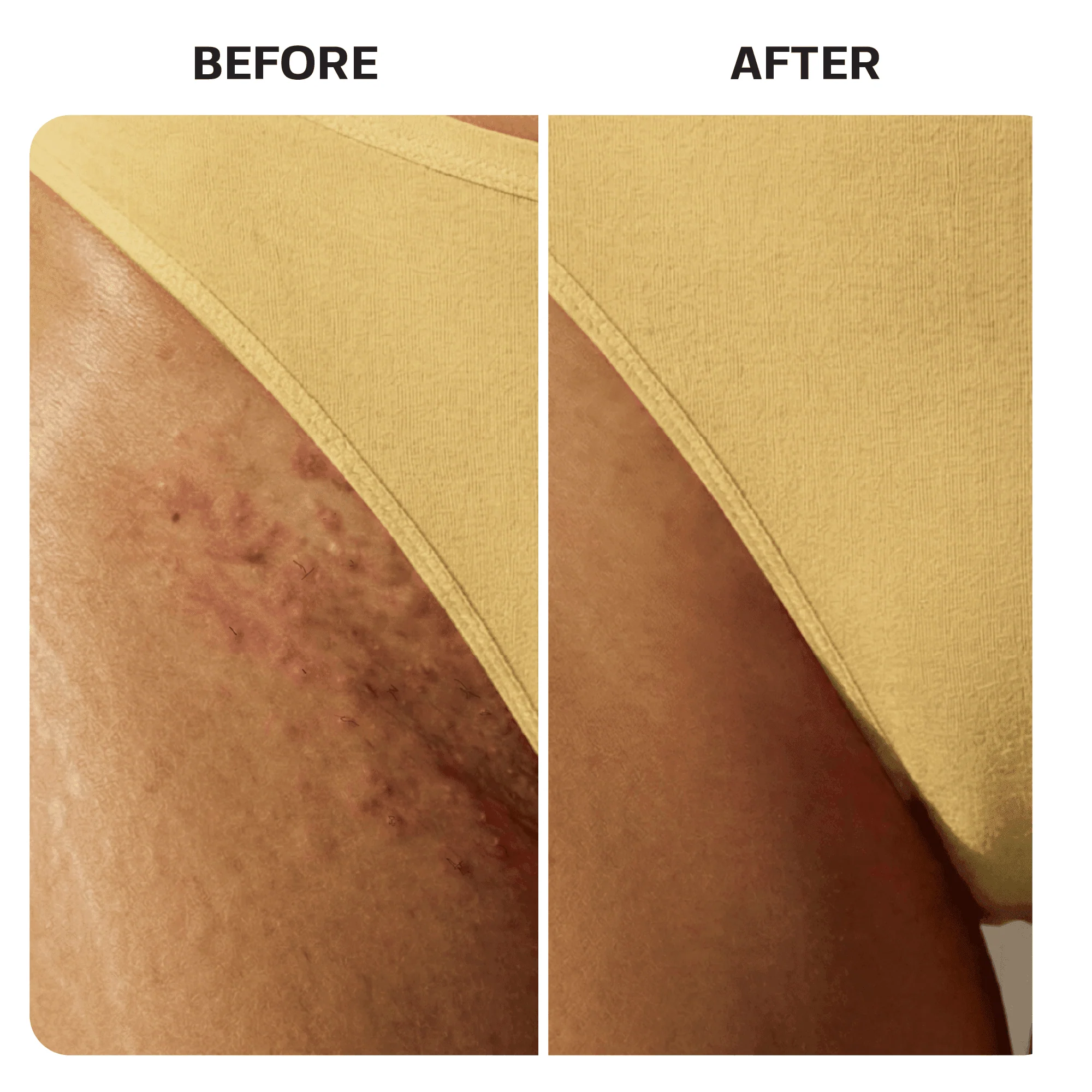 Ingrown Hair Roller Serum - Image 7