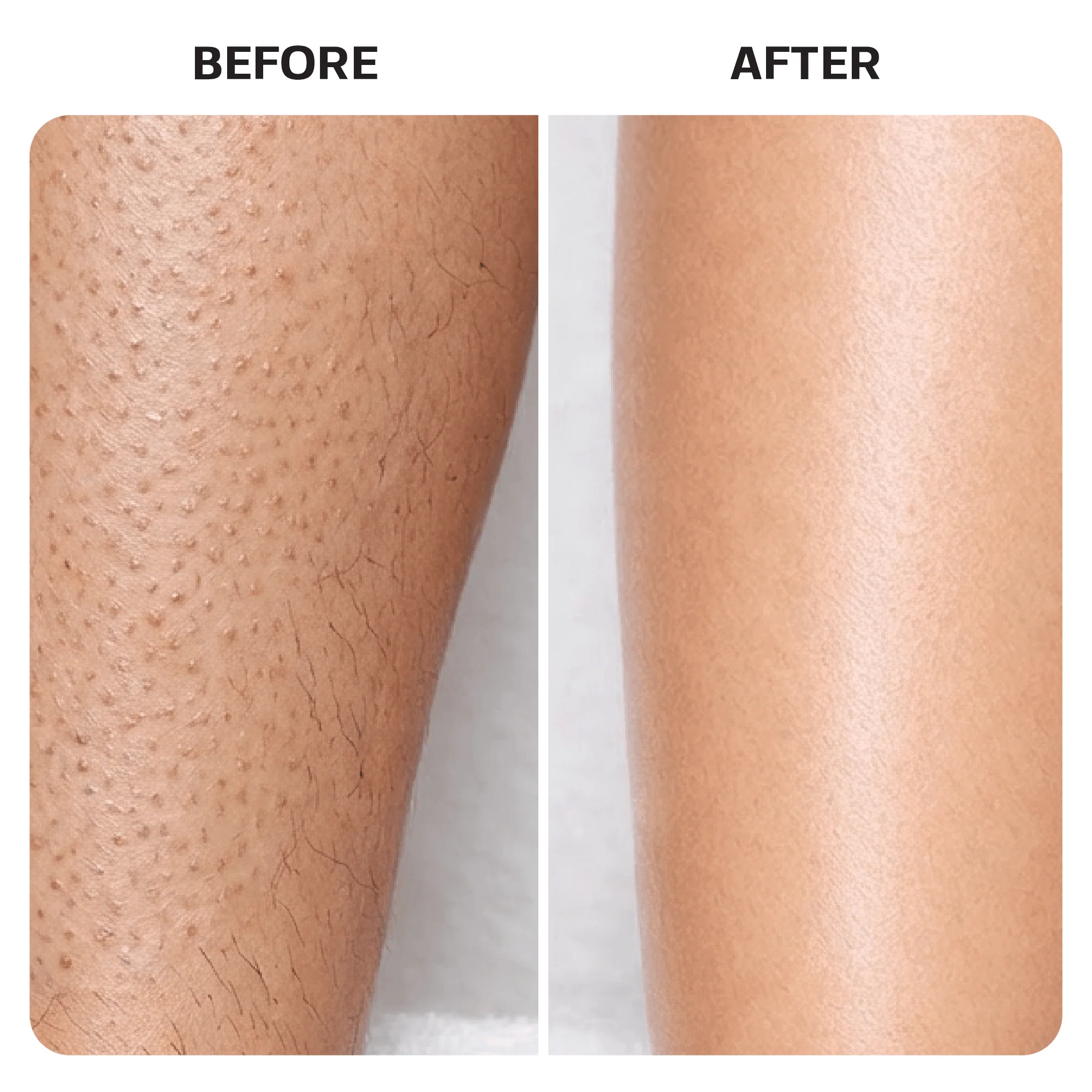 Ingrown Hair Roller Serum - Image 8