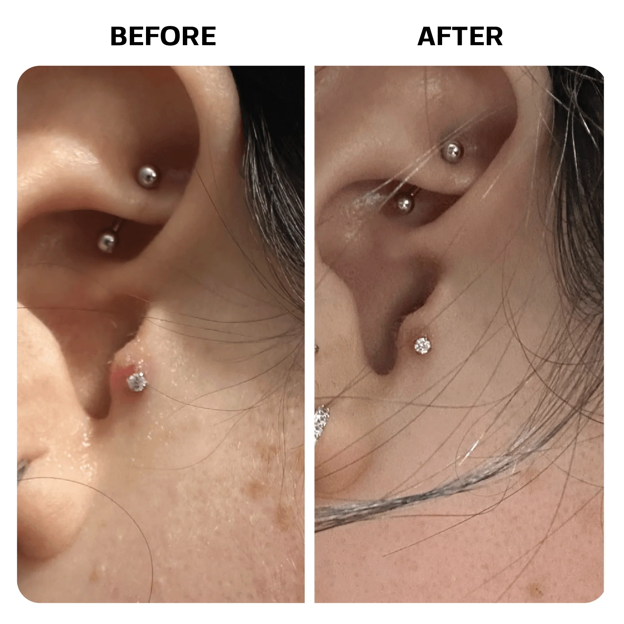 Keloid Bump Removal Gel - Image 11