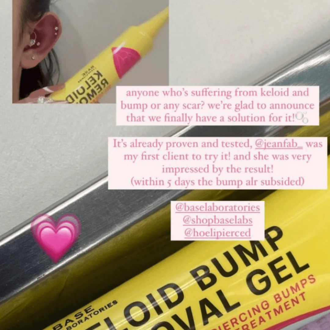 Keloid Bump Removal Gel - Image 6