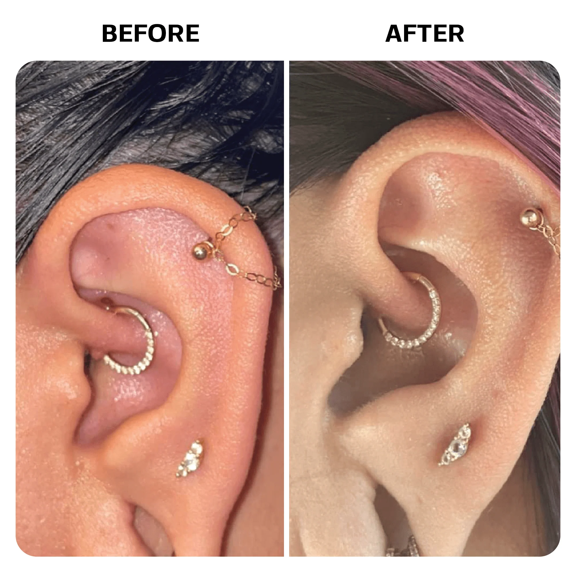 Keloid Bump Removal Gel - Image 8
