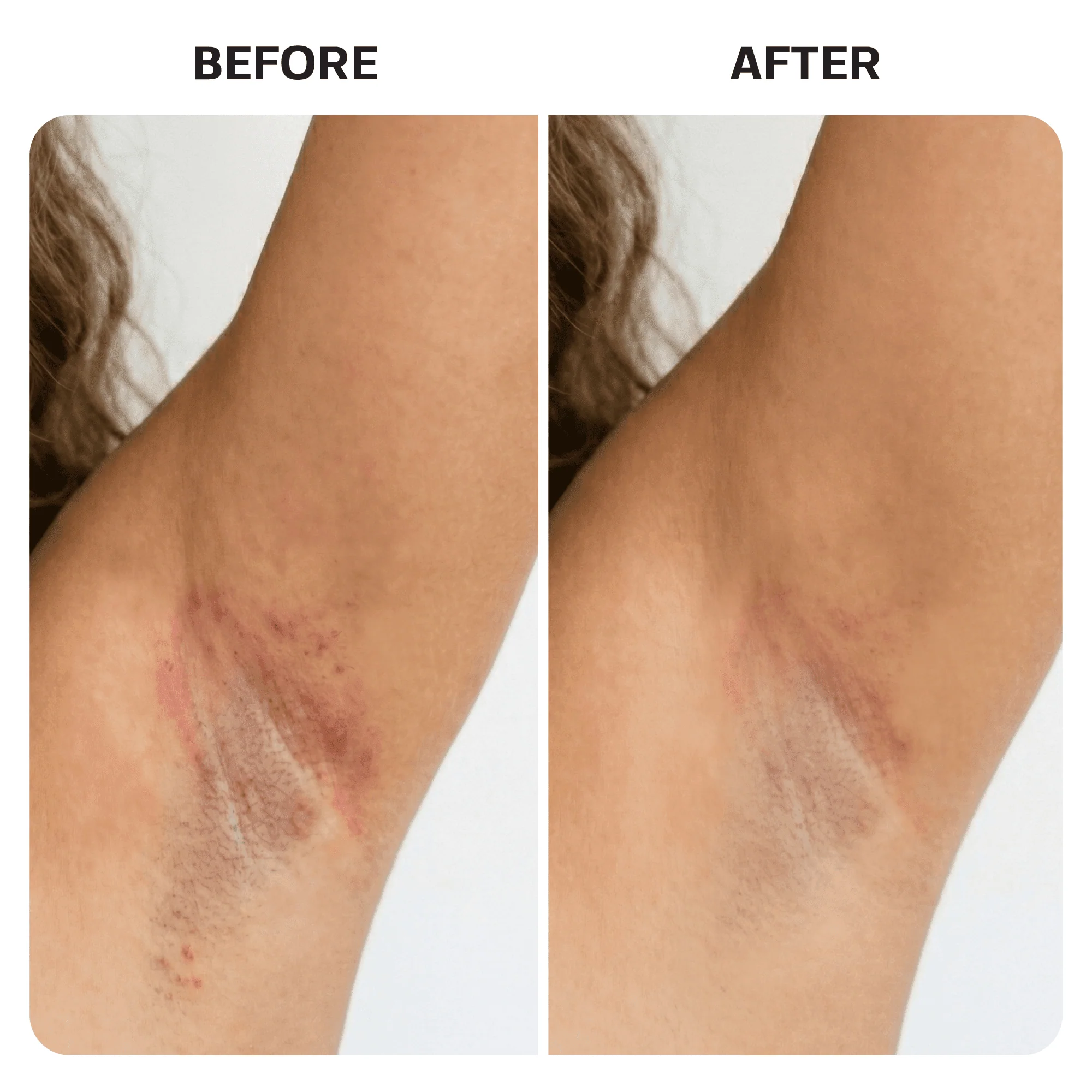 KP Bump Eraser Body Scrub - Image 10