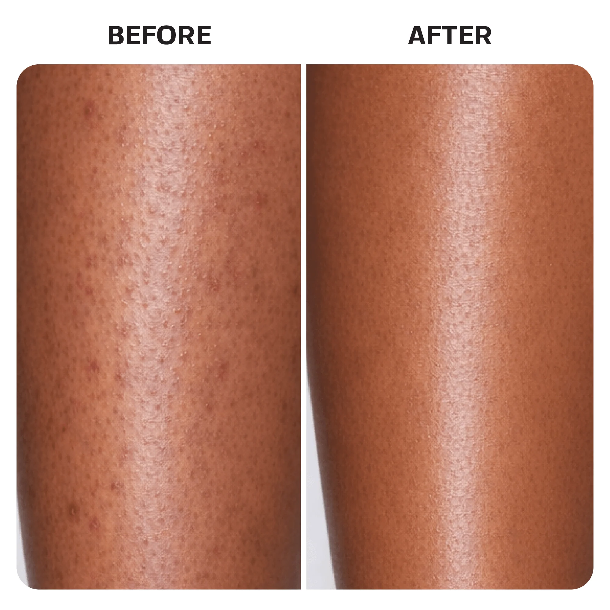 KP Bump Eraser Body Scrub - Image 8