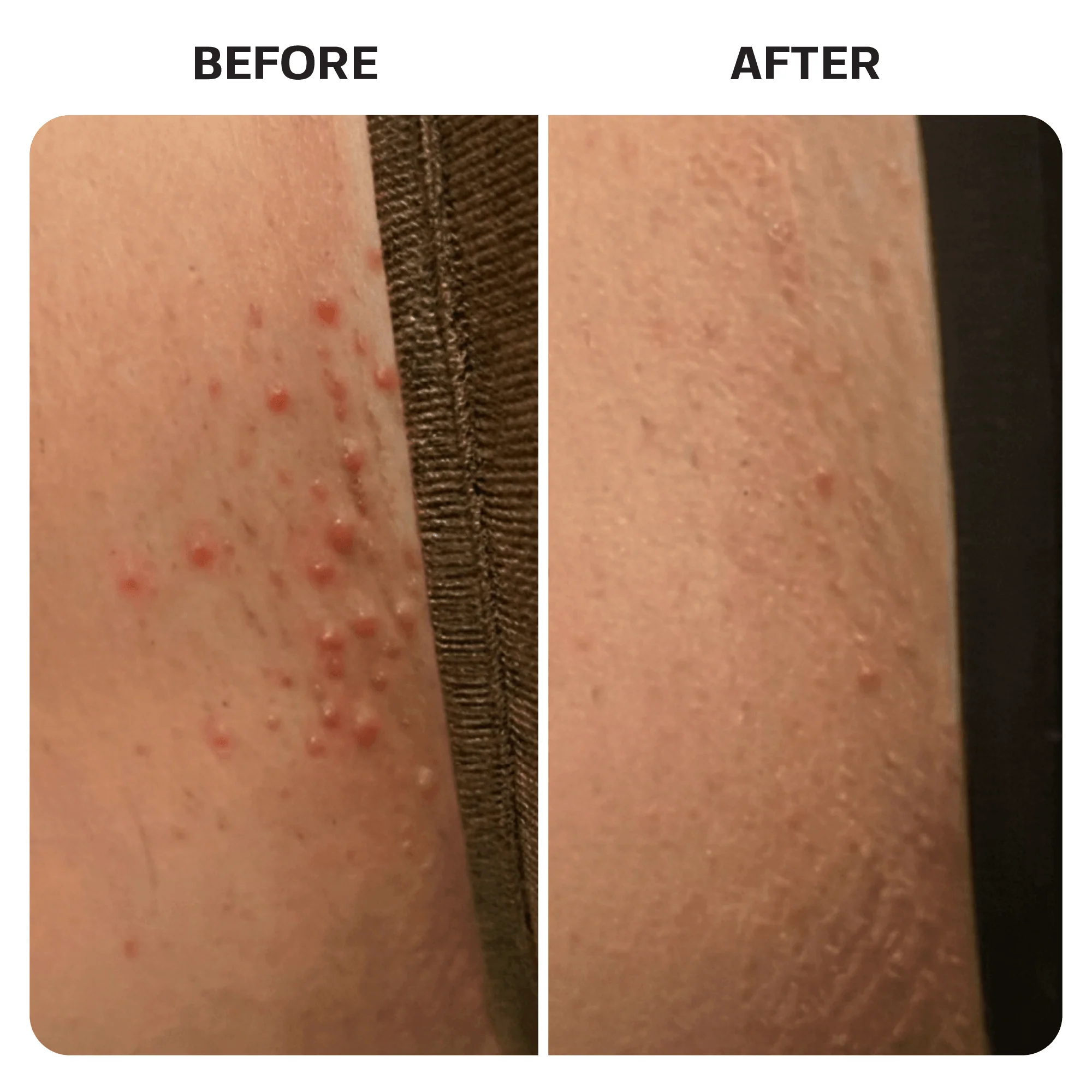 KP Bump Eraser Body Scrub - Image 9