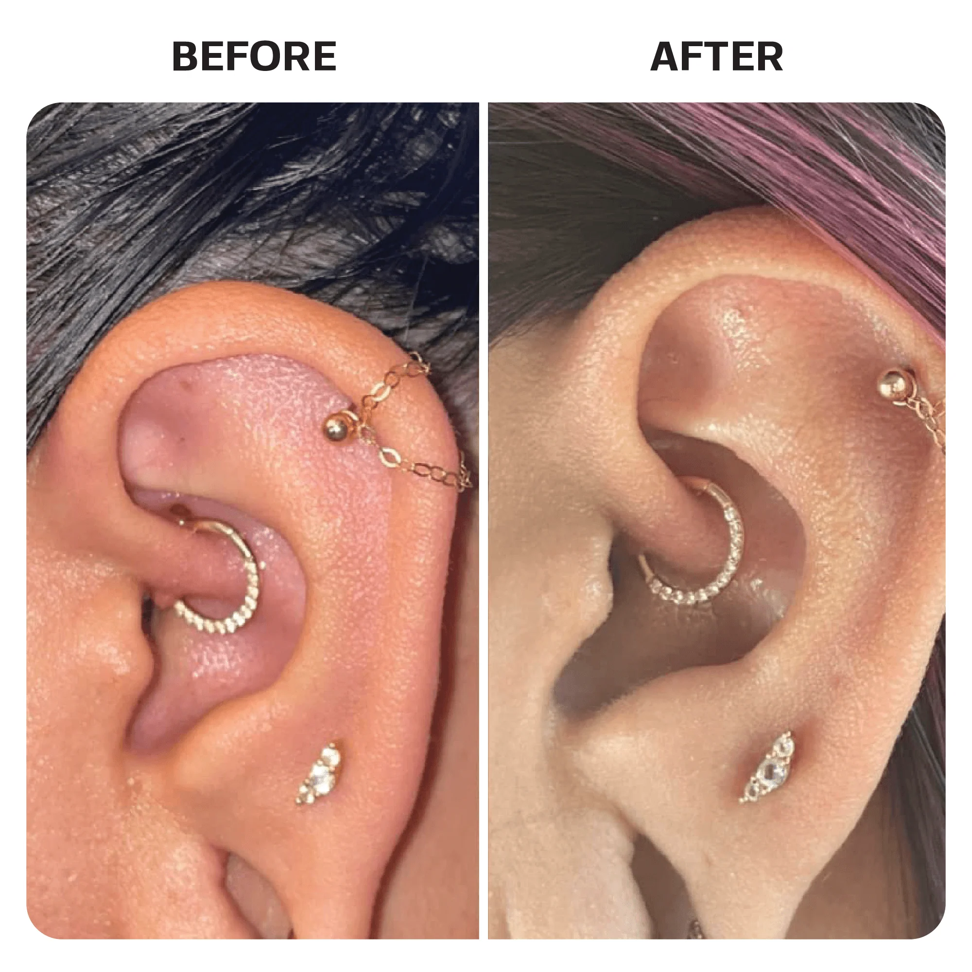 Piercing Aftercare Saline Gel - Image 6