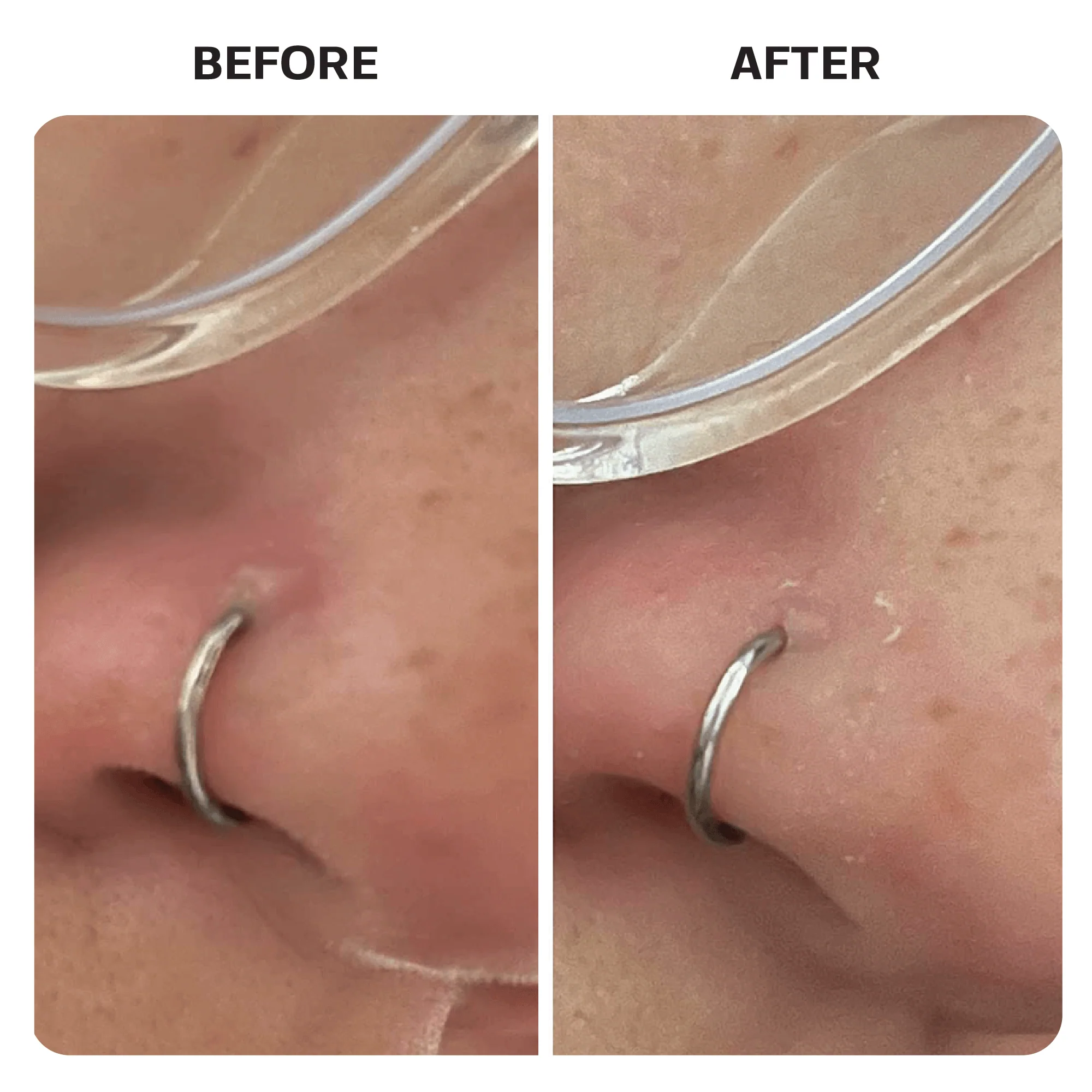 Piercing Aftercare Saline Gel - Image 7